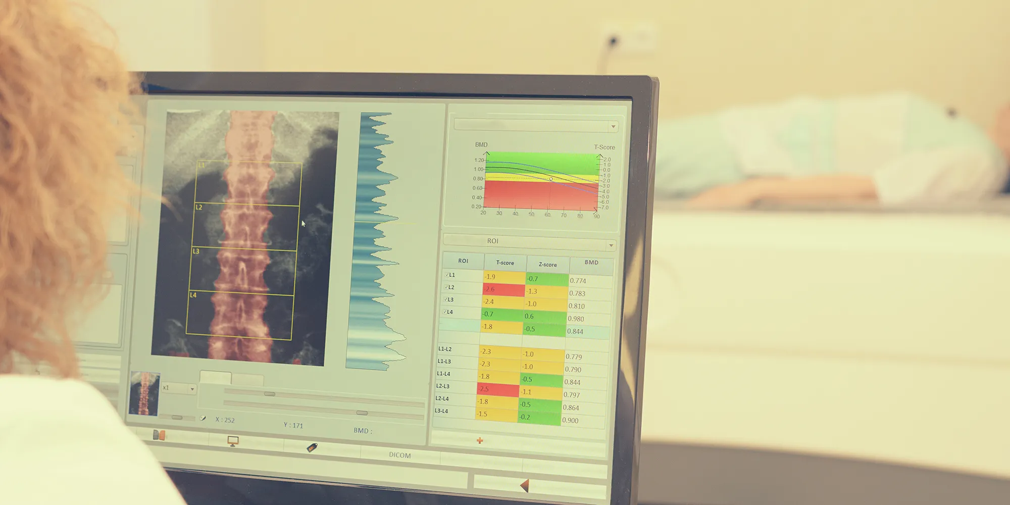 Knochendichtemessung
